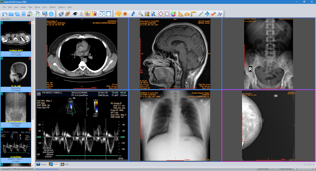 DICOM viewer PACS